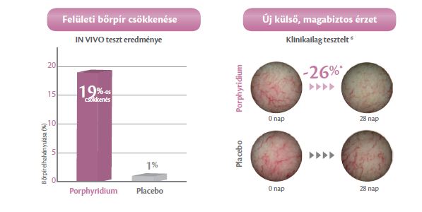 érzékeny bőr, bőrpír, érzékenység, rosacea,  cuperosa, lángoló bőr, bőrnyugtatás, érzékeny bőrre
